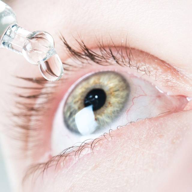 Frau benutzt befeuchtende Augentropfen