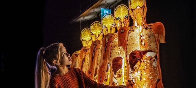 "Körperwelten" kommt nach Münster