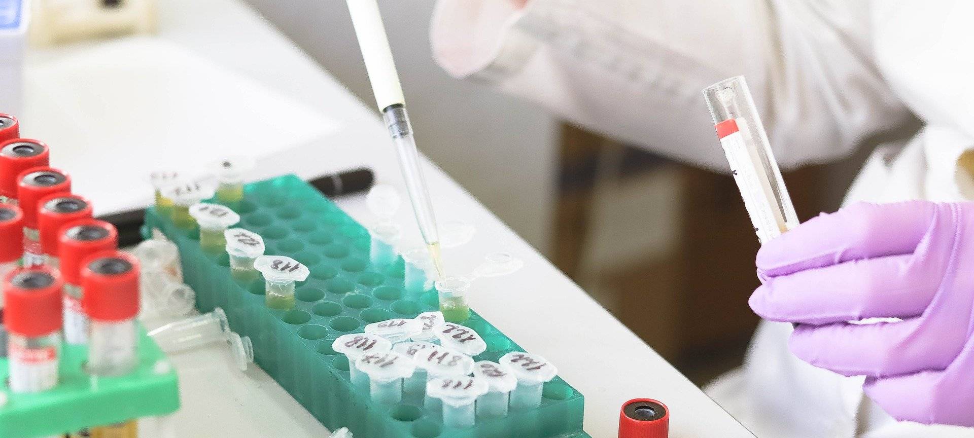 Leichenfund in Epe gibt weiterhin Rätsel auf